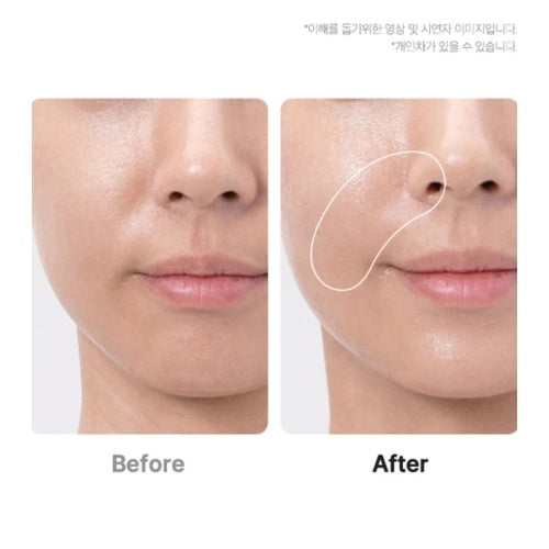 Medicube – Dispositivo Facial Portátil AGE-R Booster Pro Mini Blanco